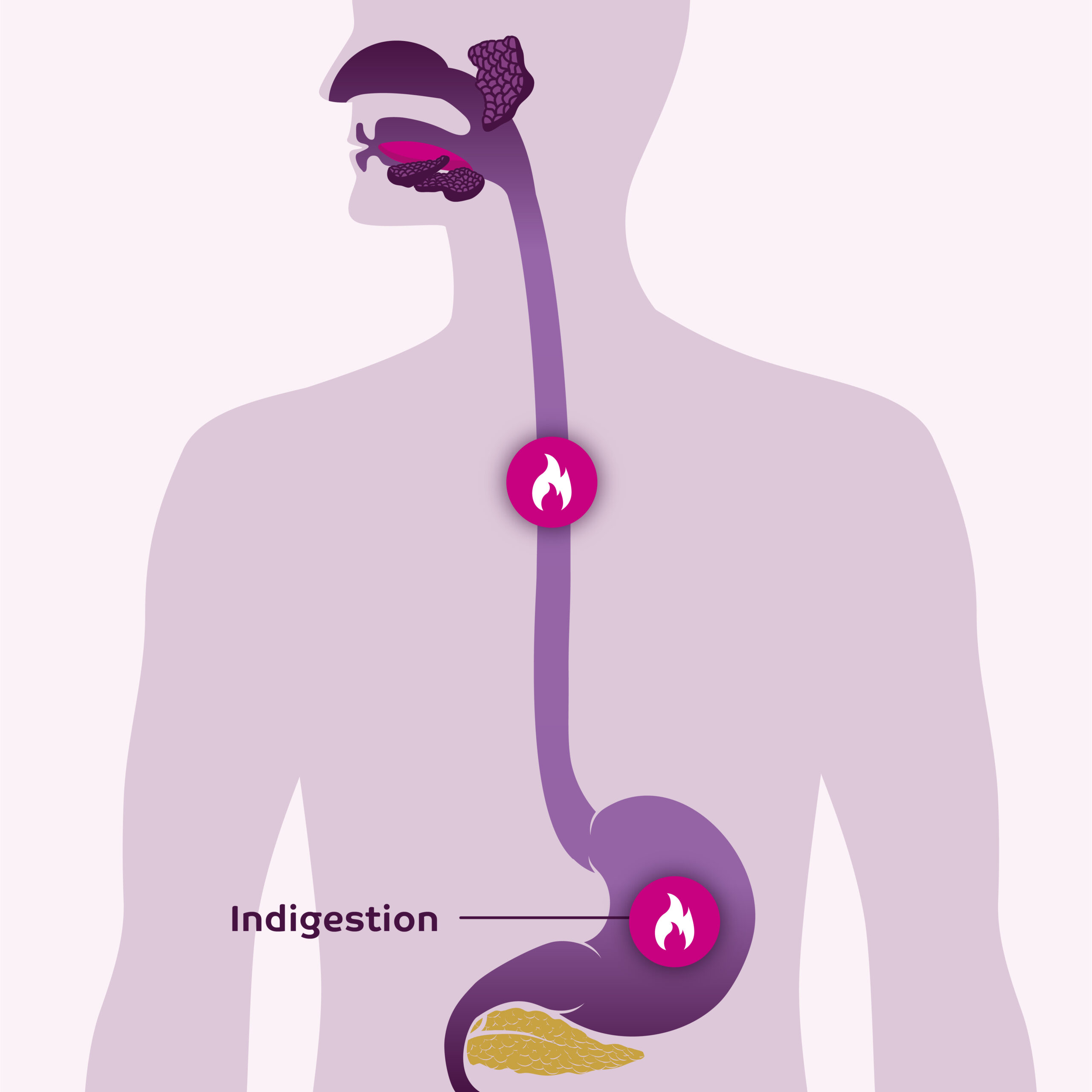 Infographic showing the feeling of Indigestion